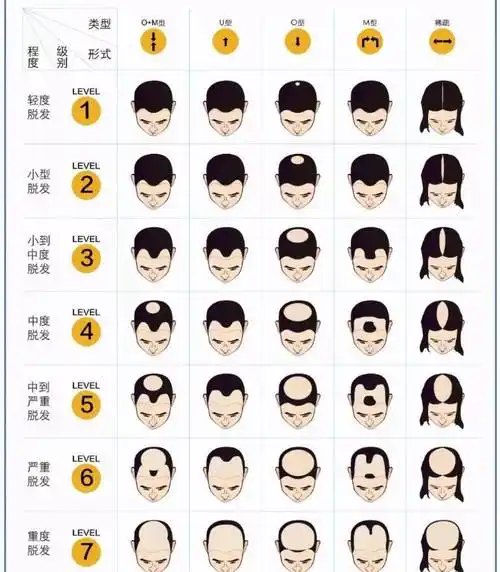 头发_头顶部_毛囊