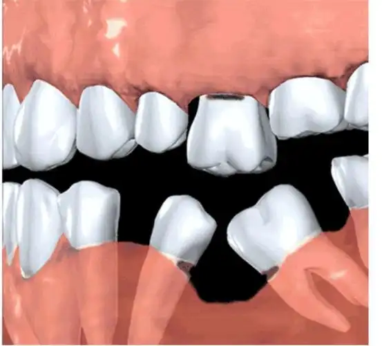 承德县医院口腔科丁艳欣的美篇 - 美篇