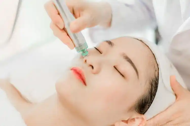 美团【尧尚】小气泡深层清洁去螨去黑头护理