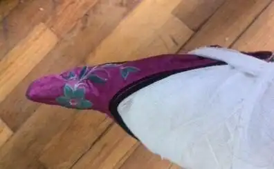 女人缠足像啥样?贴吧爆料居然有现代人这么做(多图)