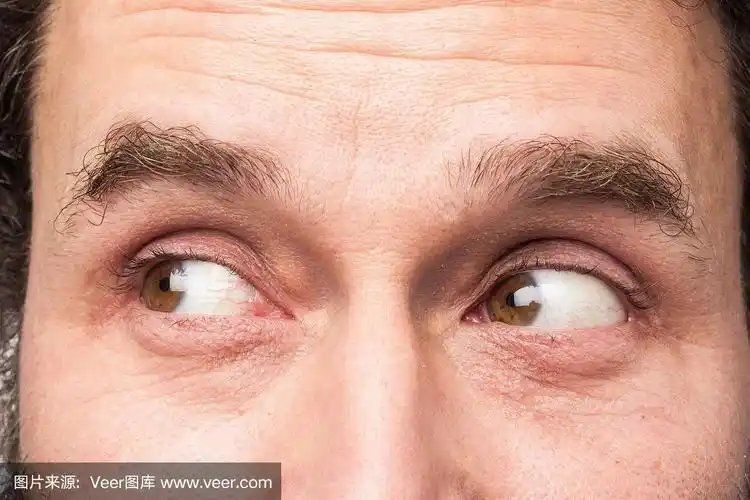 白种人的眼睛,特写,斜视
