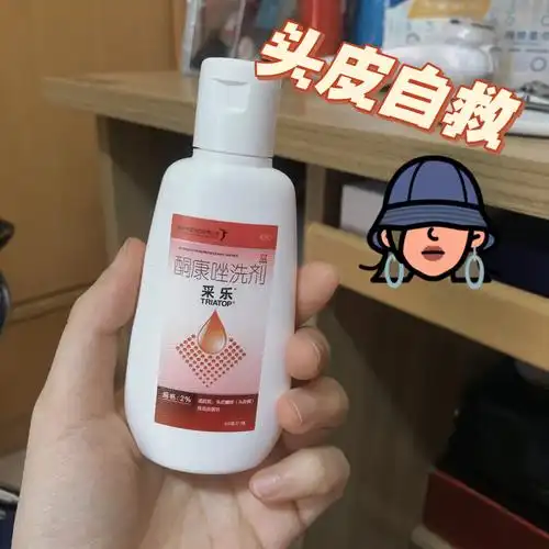 脂溢性皮炎喜欢扣头皮重度患者自救记