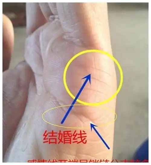 观察婚姻线,许多人的婚姻线都会出现数条,其中最深最长的一条,且代表