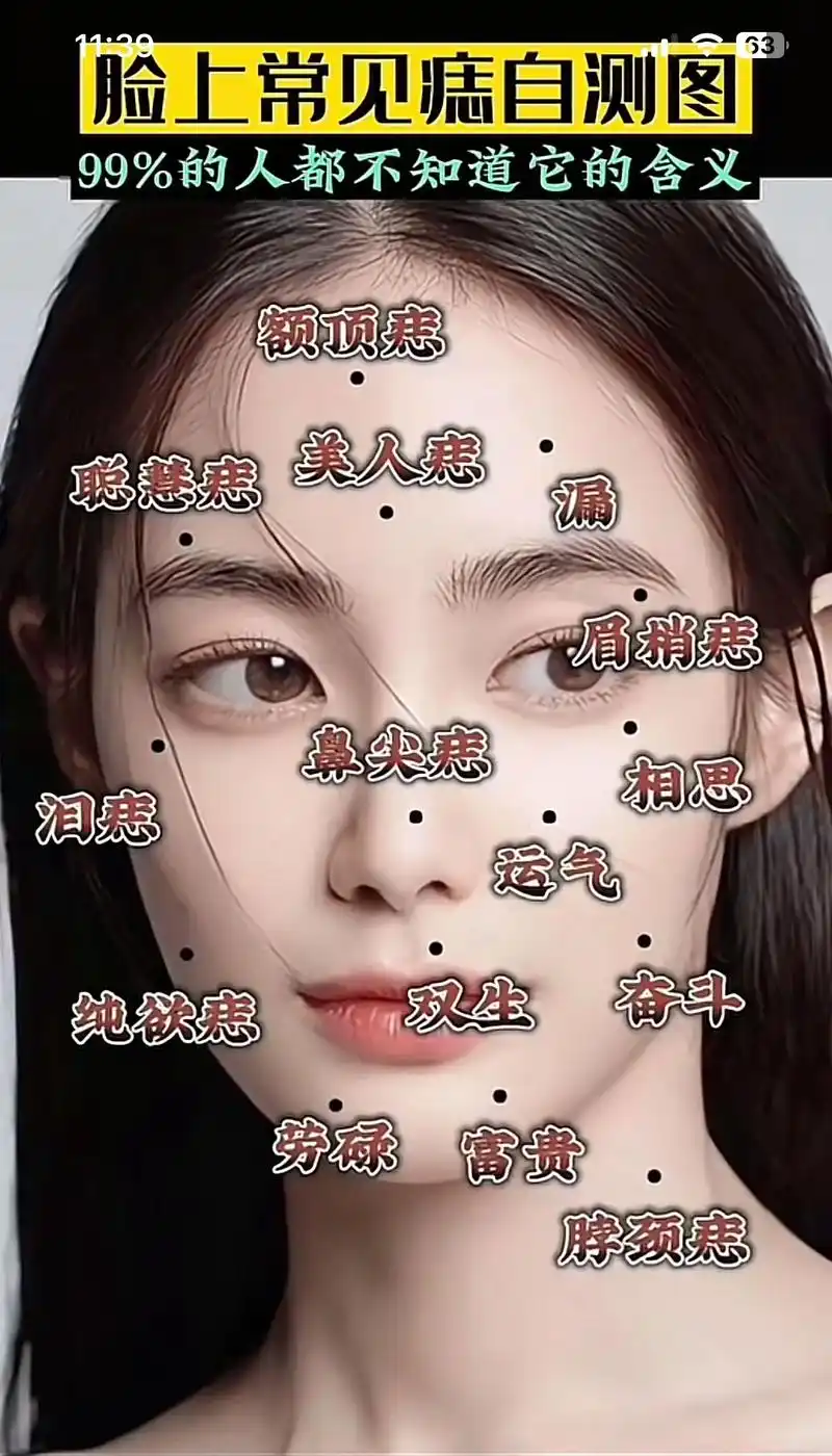 我额头有痣.#痣的含义 #左下角测试 #生肖文化 #面相 # - 抖音