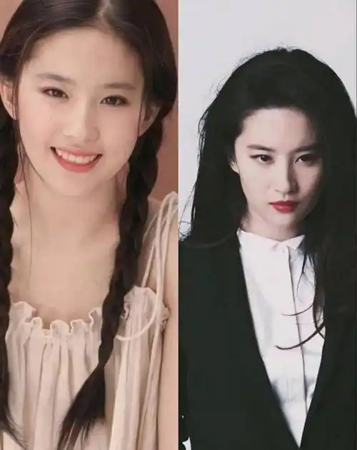 看看早起期的照片,刘亦菲面部软组织充足,加上轮廓流畅,颅顶饱满,满满