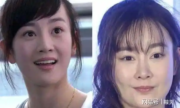 娱乐圈中整容最成功和最失败的女明星都是谁