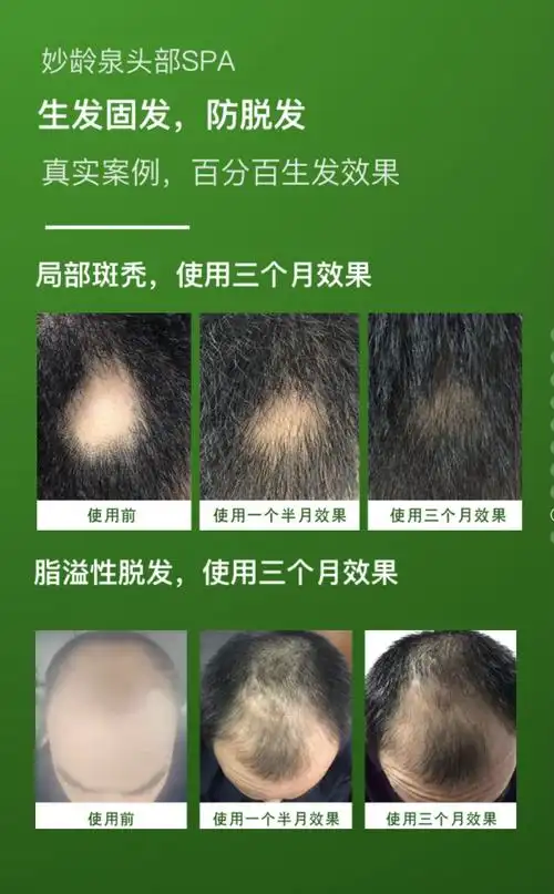 碳酸泉妙龄泉洗发护发spa