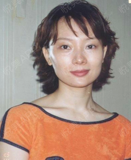 脸型动了一下减龄10几岁