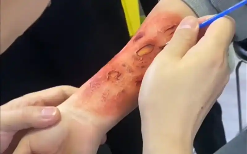 剧组的烧伤特效妆是这样化
