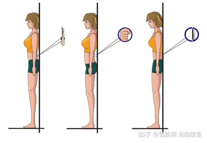 (1)骨盆前移需要我们在放松站立下,从侧面观察我们的体态,正常情况下