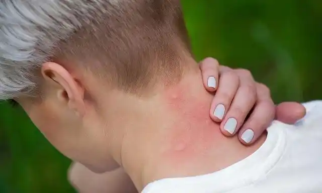 皮肤瘙痒是皮肤干吗6个原因需要治一治