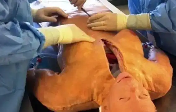 医学生们以后上解剖课,竟然要使用这样的尸体.