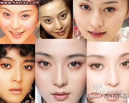 史上最全的明星整容前后对比照片 [图]