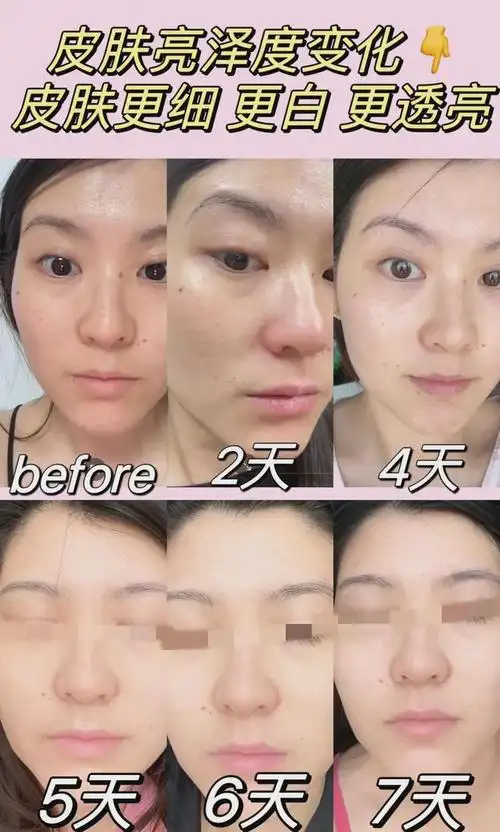 这变化,太惊人了吧|淡斑|抗皱|面膜|美白针_网易订阅