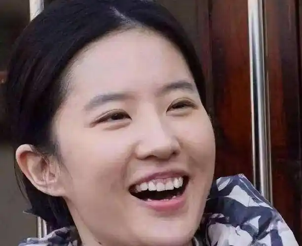 明星"烤瓷牙"有多可怕?