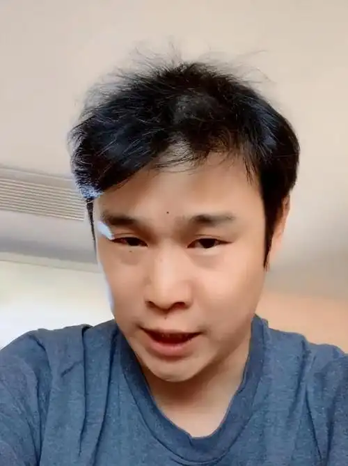 头发稀疏,发际线高的50岁男人,发型记住"3要3不要",帅气有型