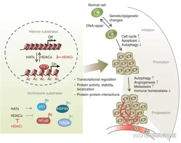 肿瘤表观遗传第三讲组蛋白乙酰化