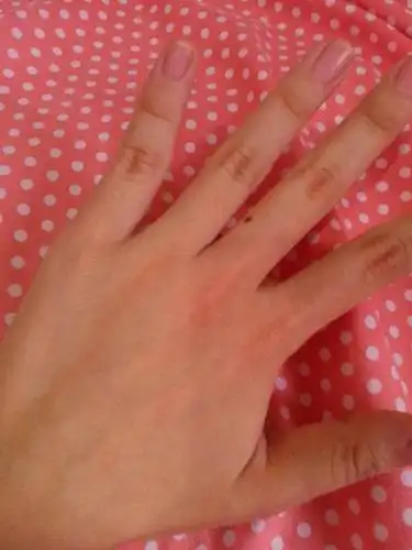 左手中指上有颗痣是代表前世的姻缘要今世来续是真的假的?