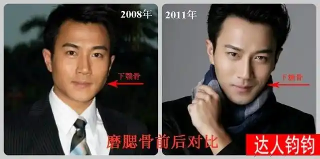 杨幂新欢刘恺威整容前后对比照大曝光(组图) - 中国承德官网的日志