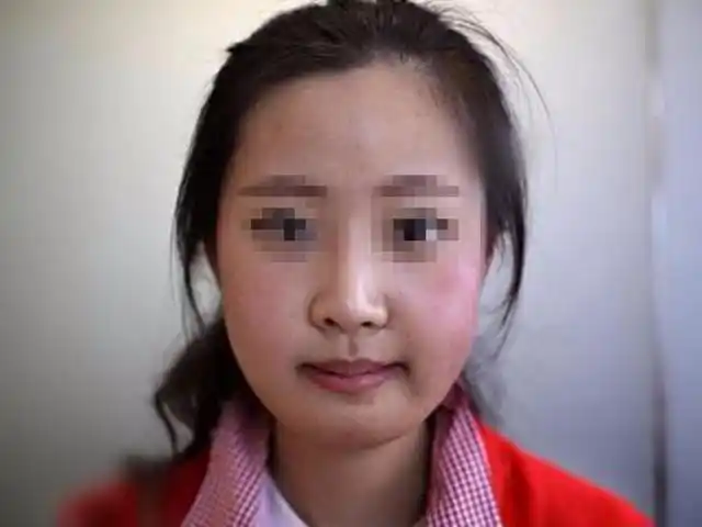 13岁开始整容,3年动刀上百次,30万人追着捧,这个女孩会后悔吗