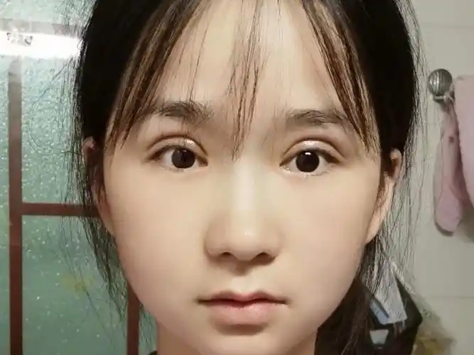 我比较喜欢平扇形双眼皮,它综合了扇形和平行的特点,_圈子-新氧美容