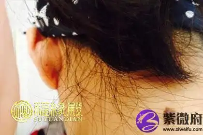 脖子后面有痣的女人命运好不好