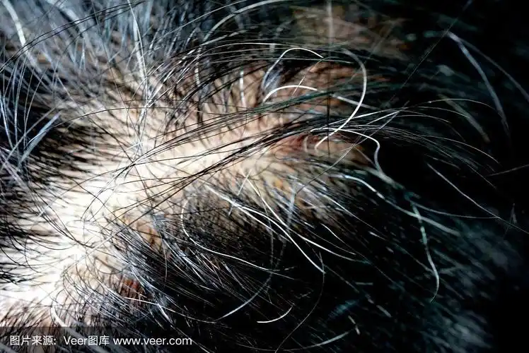 近看白头发的发根女人