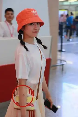 李兰迪瘦了穿短裙甜美可爱胳膊上的牙印十分吸睛