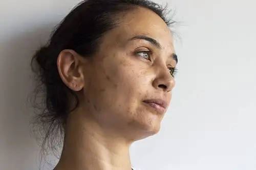 皮肤出现暗黄,它的原因有很多.