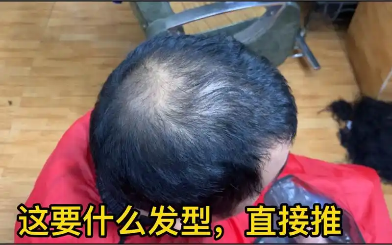 32岁大哥秃顶剪6mm寸头,3分钟分享基础手法,学会省300块大洋_哔哩哔哩