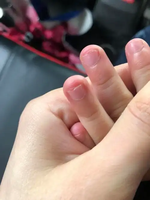 求助大家,孩子老是咬指甲怎么办?