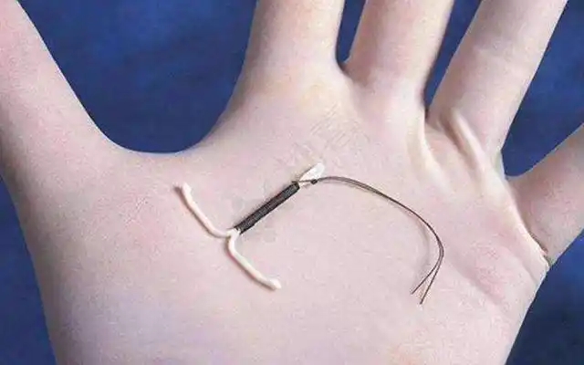 节育环不取出会长到肉里吗妇科主任取环年龄不要超这个岁数