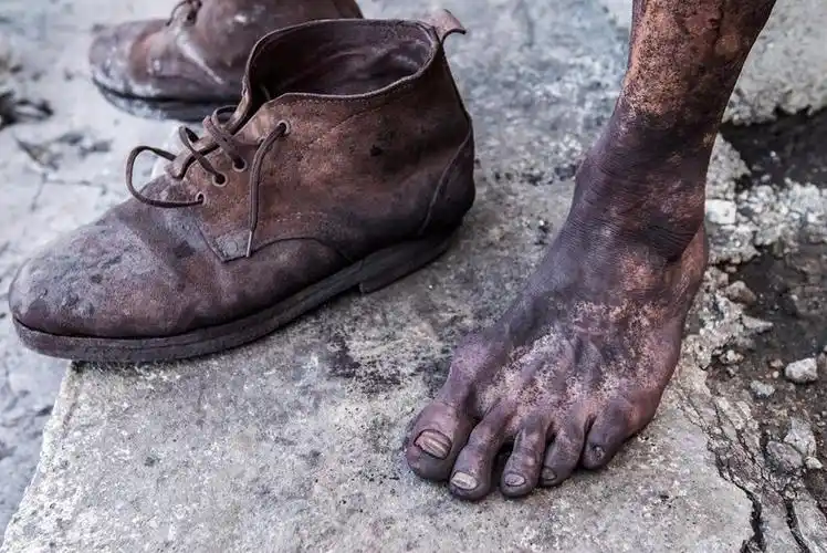 工友的"黑脚"和工鞋.