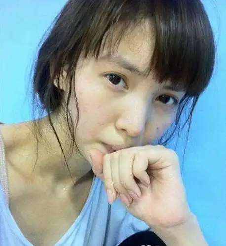 金晨坦言睡前不敢照镜子?无滤镜下黑头痘痘全暴露,网友:好真实