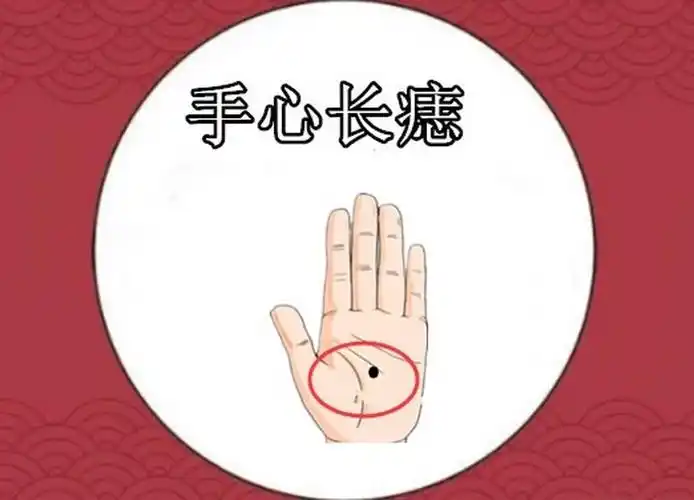 就以彼此掌心的痣作为相识的记号当一个人的右手的掌心痣和另一个人