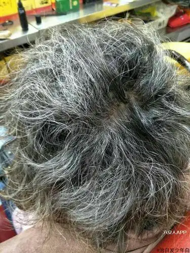 来自治白发少年白的老乡圈
