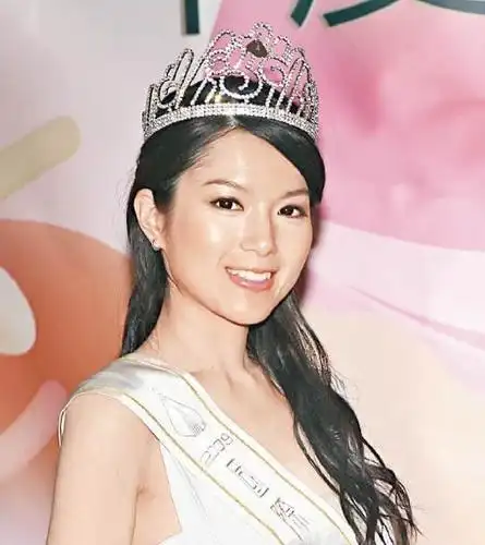 37岁tvb前女星苟芸慧酒店隔离撞伤头,流血送院,健康经常出问题