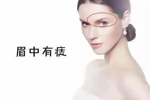 女人10处有痣是富贵痣有1处即寓意发财不可随意点掉