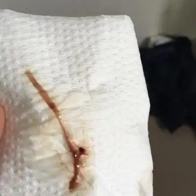 是的呢,不过很多见红了也不是马上就生的 我