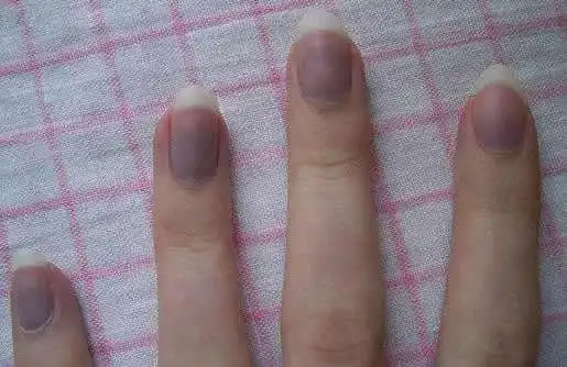 指甲与身体健康息息相关|7种指甲颜色代表身体不同健康状况 内附改善
