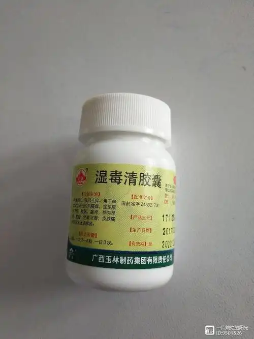 原介绍两种治疗湿疹皮肤瘙痒的中成药