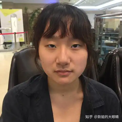 请问我这样是眼提肌无力吗