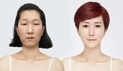 let美人文女士整形前后对比图