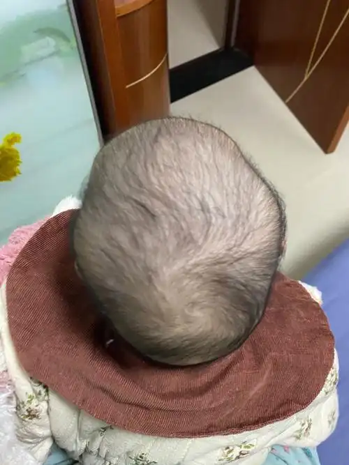 求助有宝宝的姨姨们宝宝头型怎么纠正呢