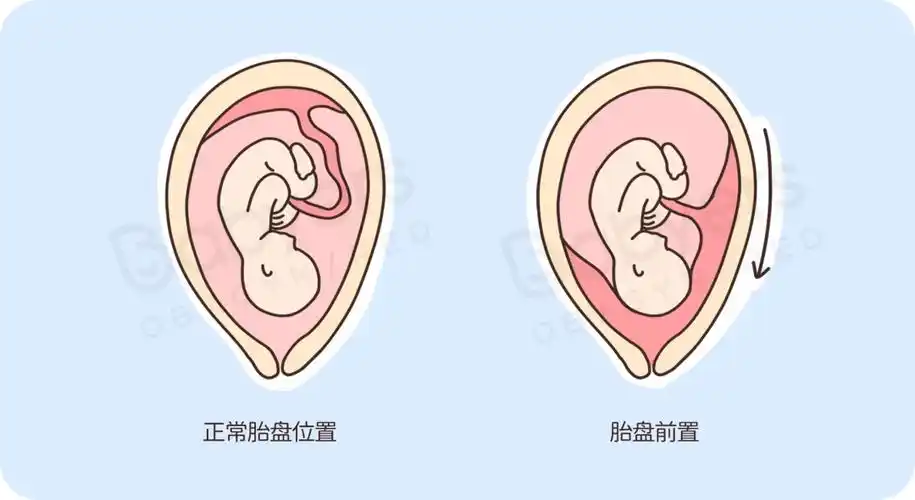 杭州美华提醒:胎盘很重要!但最后得当「垃圾」丢了