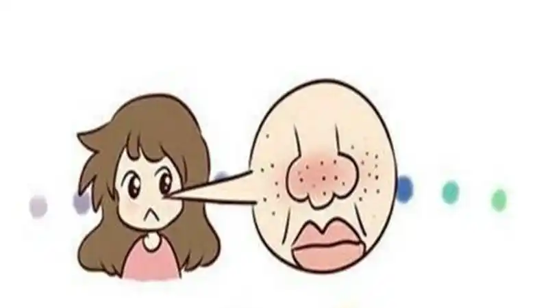 毛孔堵塞怎么办怎么疏通