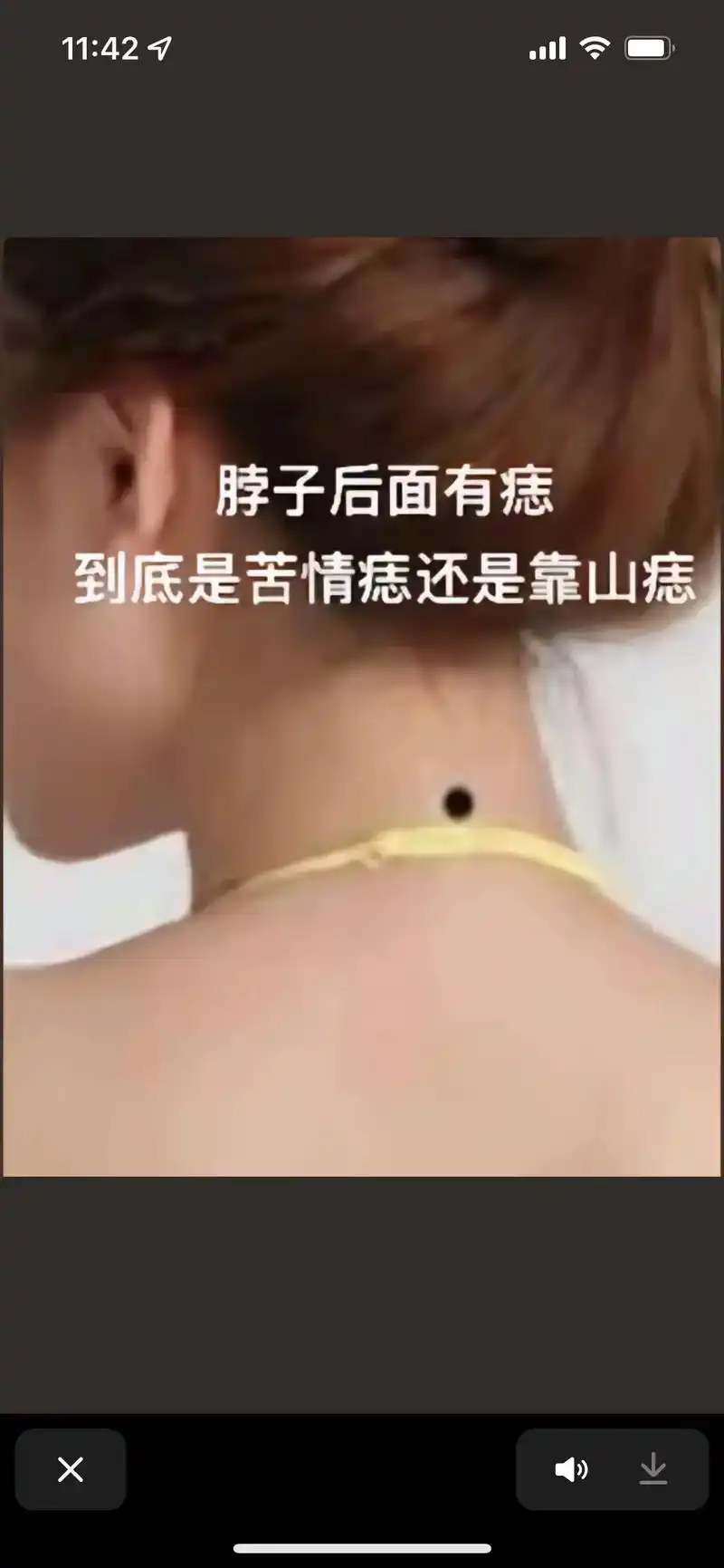 脖子后面有痣 尘底是苦情痣还是靠山痣