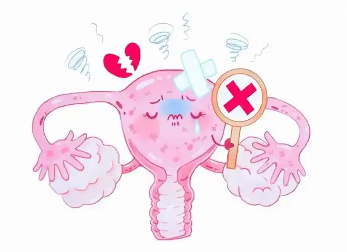 哪类人群易患宫颈癌?早期症状有哪些?_女性_患者_阴道