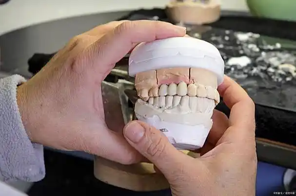 种植牙会不会影响咀嚼能力