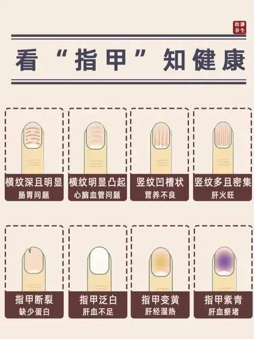 8种异常指甲纹路看健康Ⅰ一秒自检身体状况